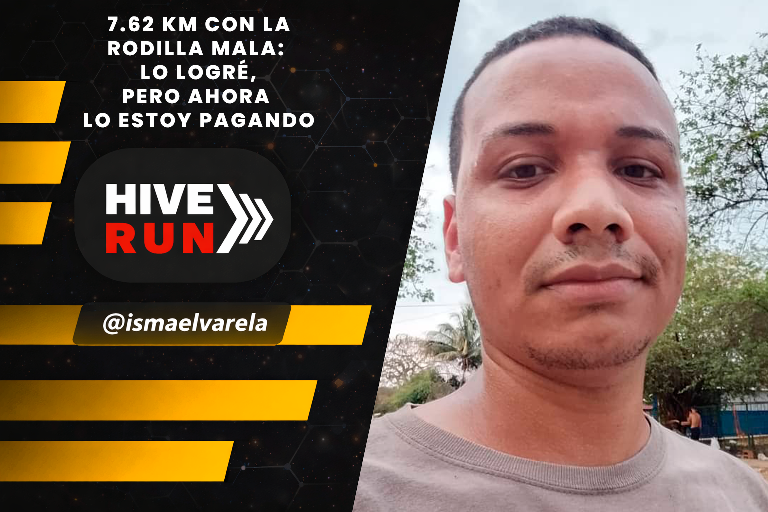 7.62 KM whit a bad knee: I did it, but now I´m paying for it / 7.62 KM con la rodilla mala: lo logré, pero ahora lo estoy pagando