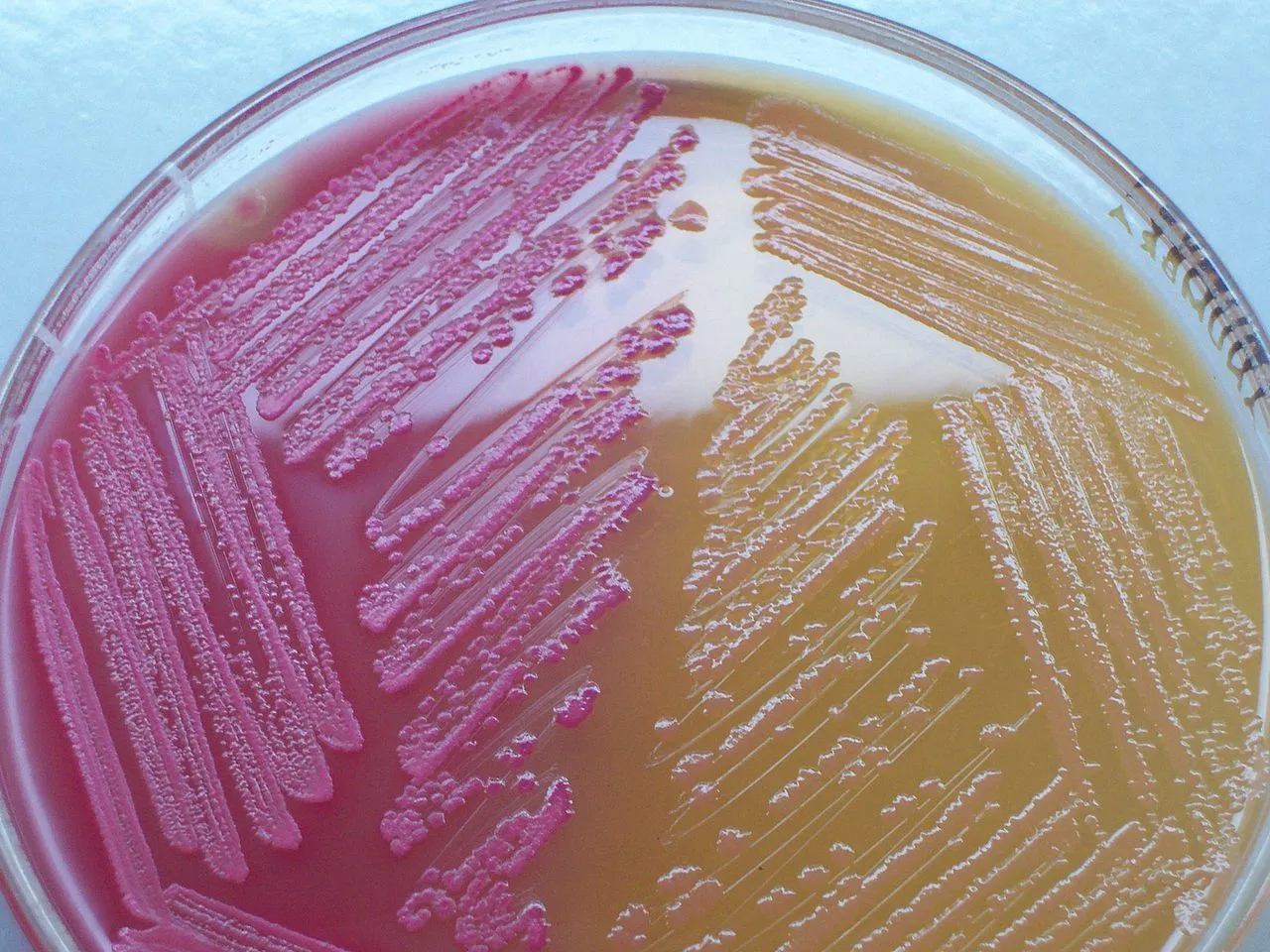 1280pxMacConkey_agar_with_LF_and_LF_colonies.jpg