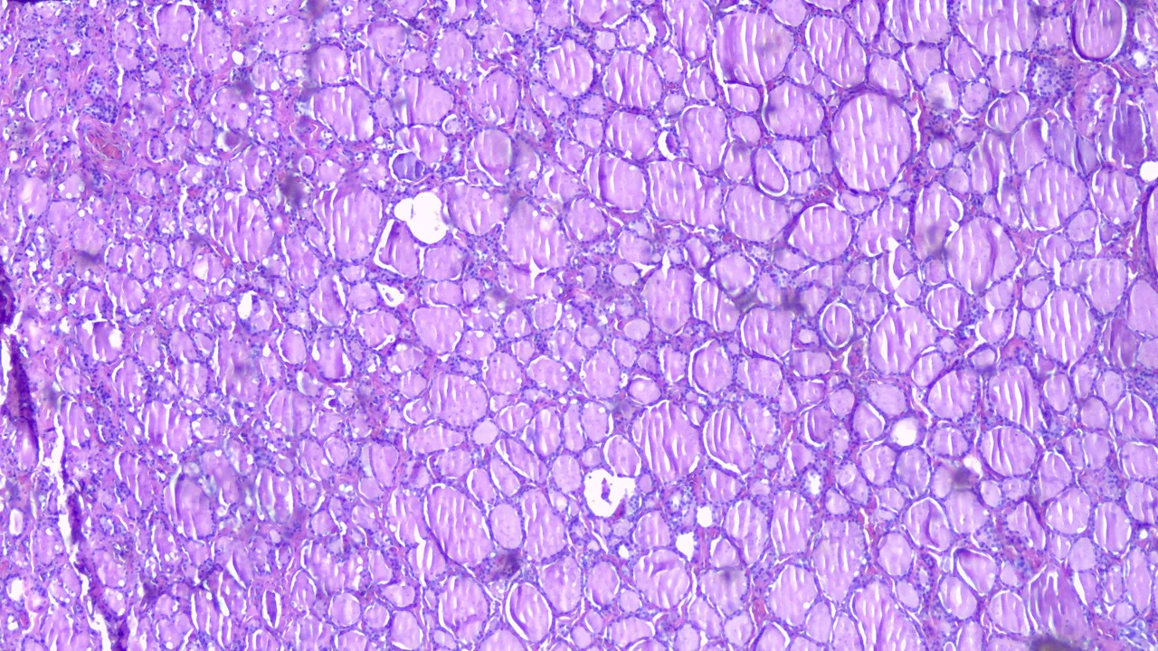 Thyroid Tissue Scan.png