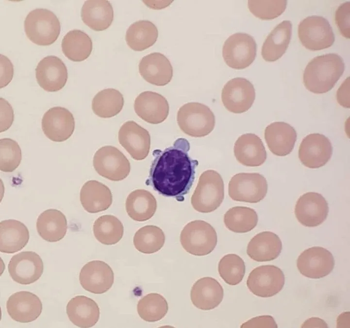 Lymphocyte.jpg