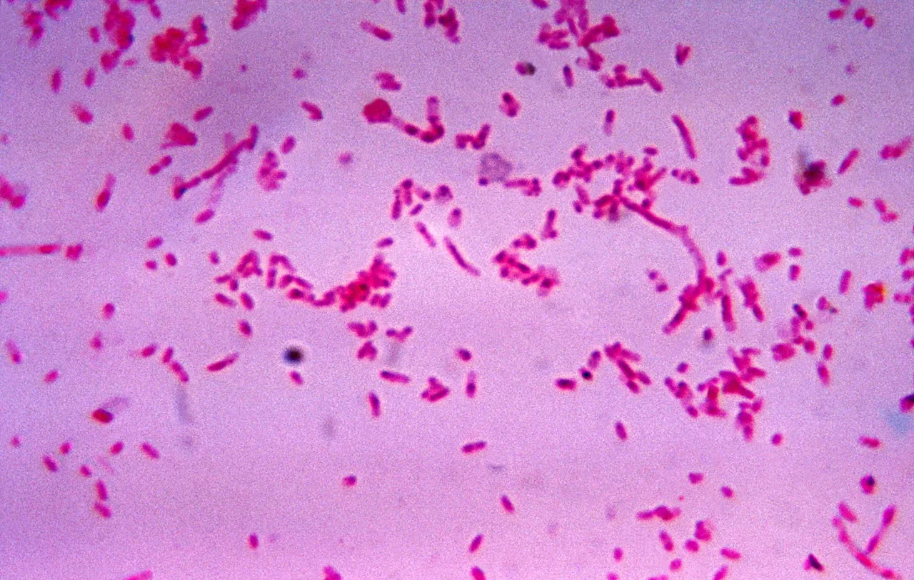 oil degrading microorganism Fusobacterium_novum_01.jpg