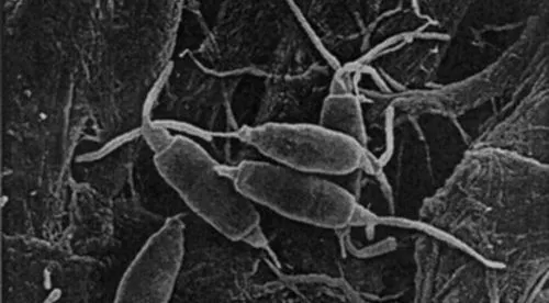 Pestalotiopsis-microspora-hongocomeplastico.jpg