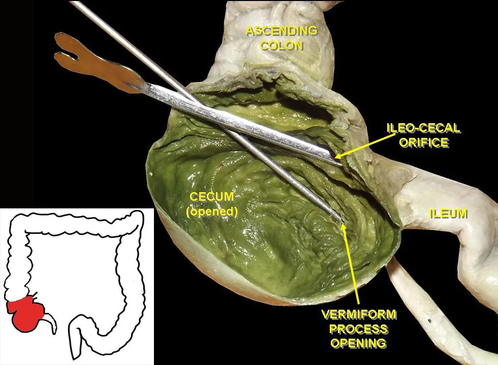 cecum human.jpg