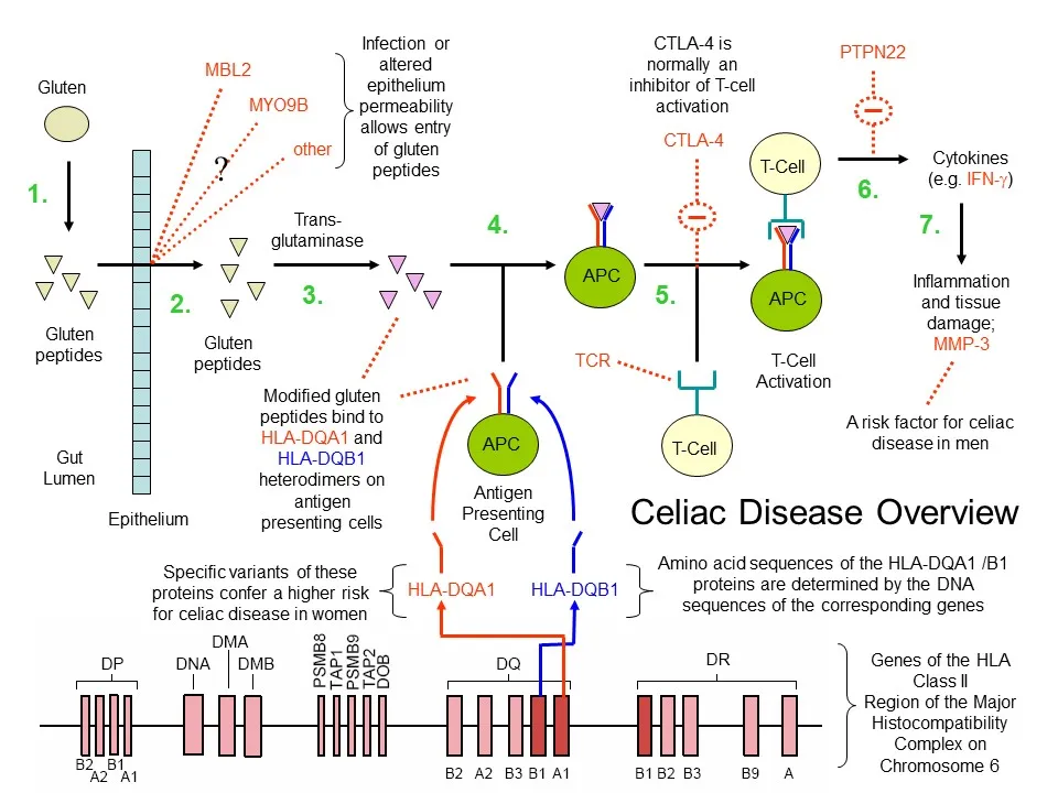 Celiacdisease.jpg