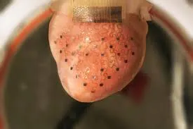 Pacemaker Devices1.jpg