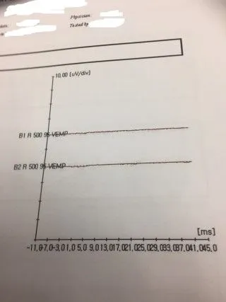 술후95vemp.jpg