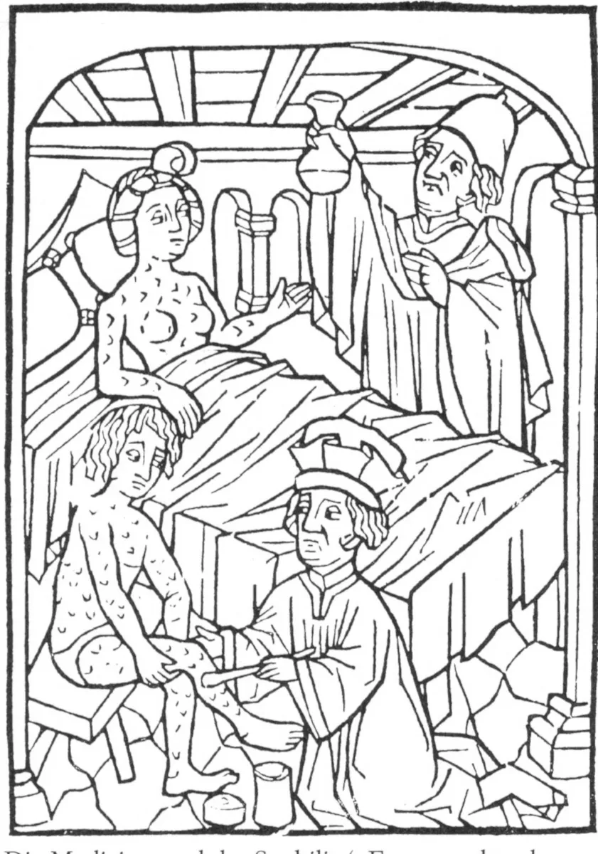 Syphilis treatment Bartholomäus Steber public.jpg