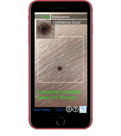 iPhone_Medic_Mole_large.png