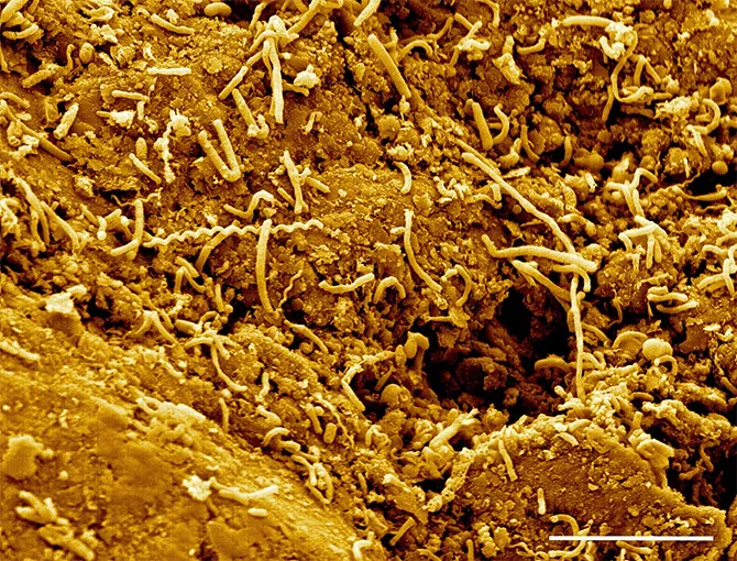Microbial Life in Deep Biosphere