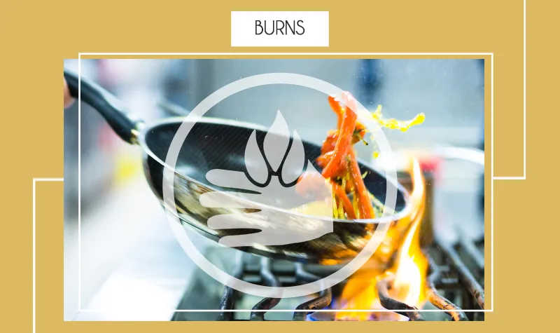 burns.png