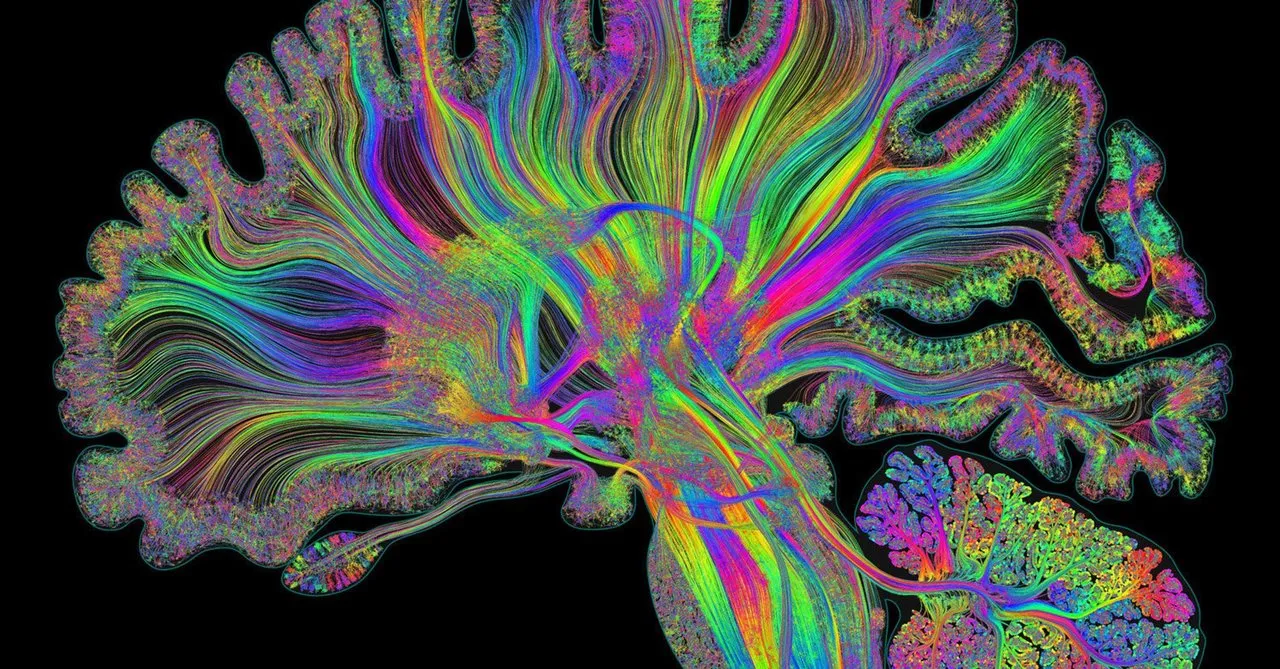 brain.jpeg