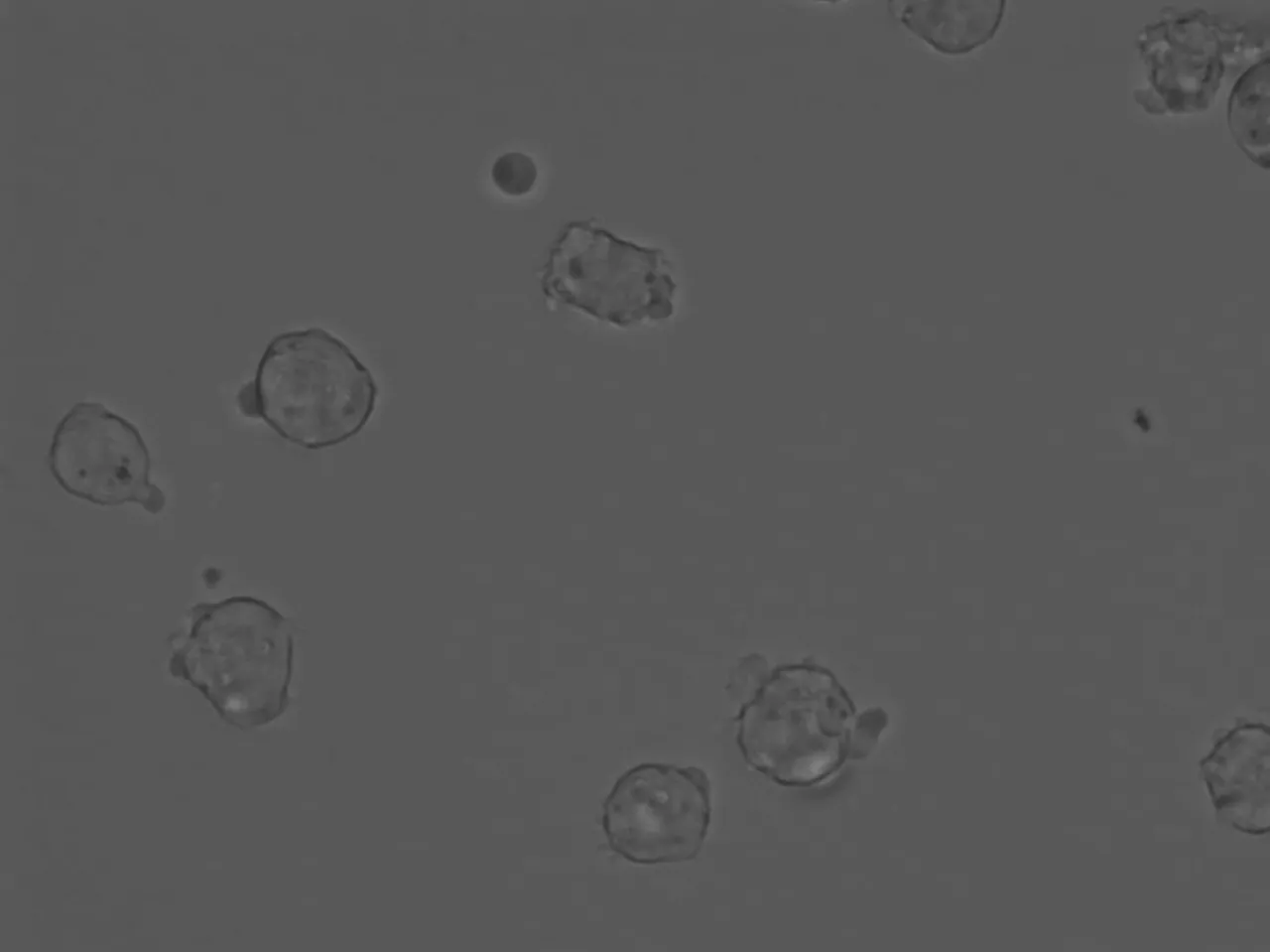 HL60cells320X.jpg
