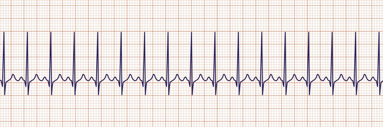 ACLS-Figure-24.jpg
