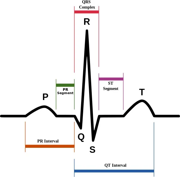 SinusRhythmLabels.svg.jpg