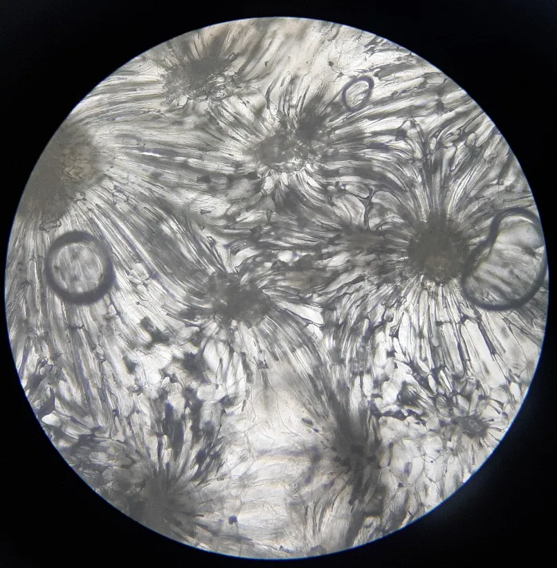 The hard tissue cells of guava
