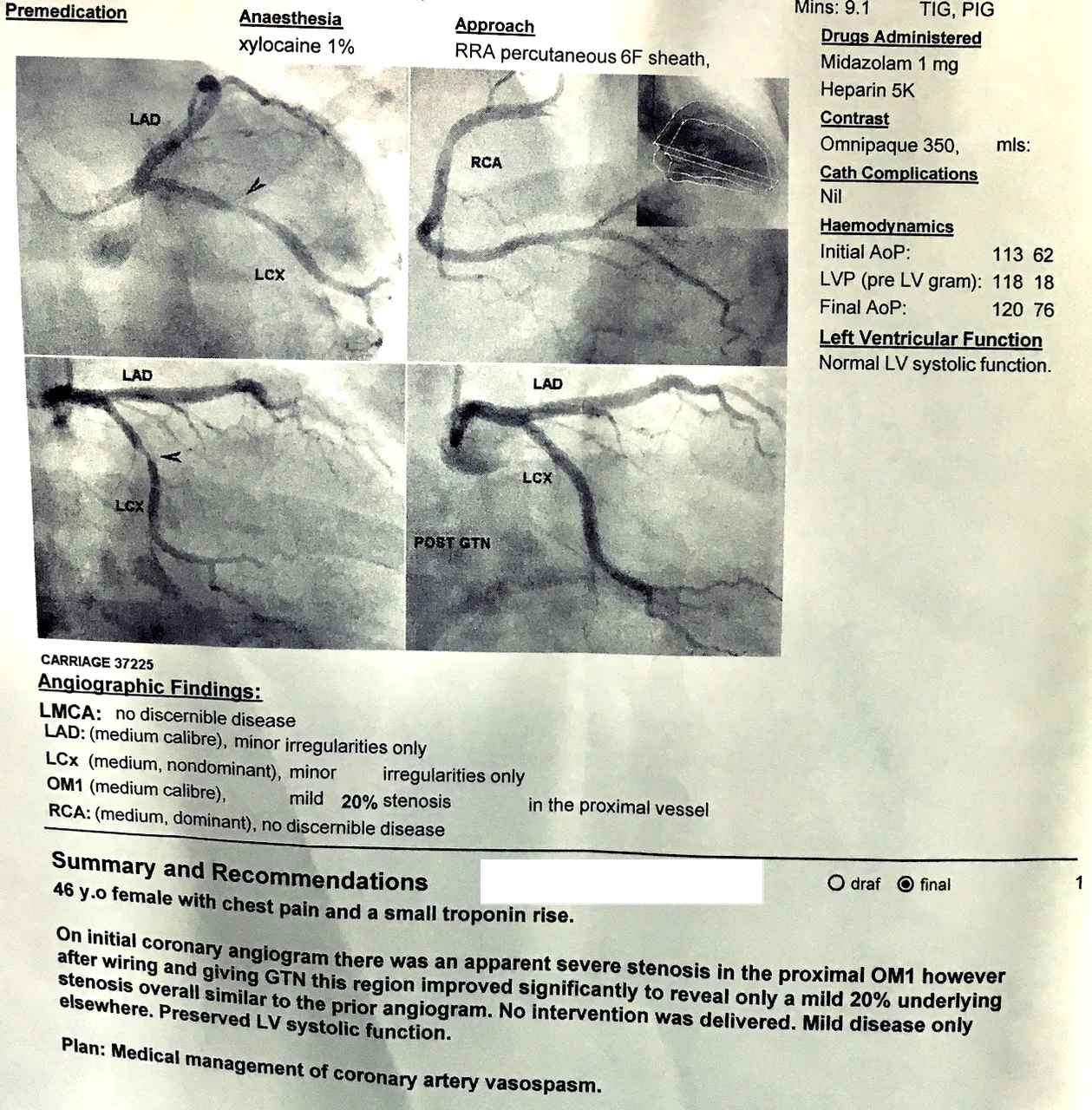 ANGIOGRAM CUT.png