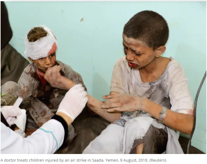 yemeni children injured by saudi airstrikes.png