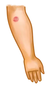 brazo1 - peq.png