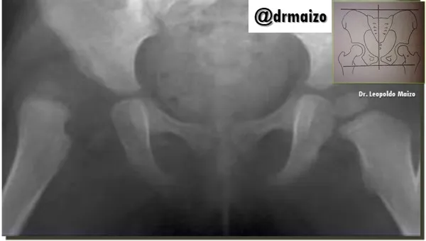 Diapositiva1.JPG
