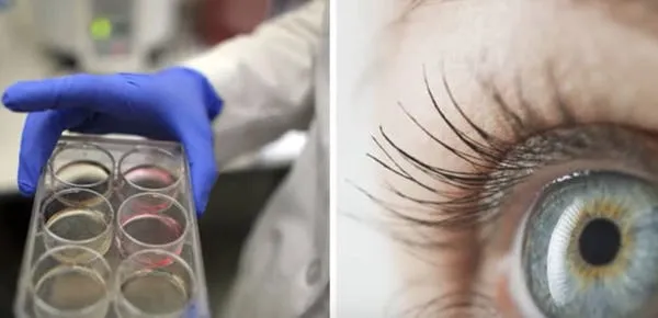 scientists-restored-the-sight-of-two-blind-patients-which-could-mean-an-eventual-cure-for-blindness-photo-u1.jpeg