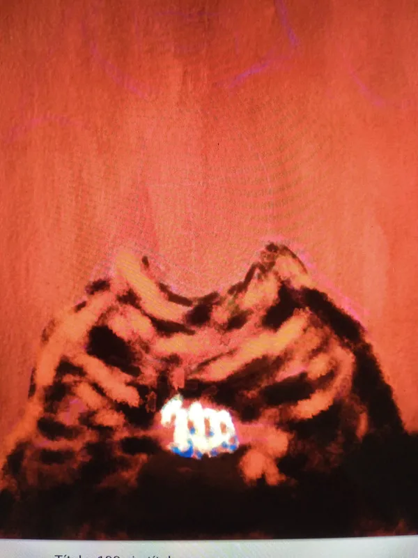 MyArt