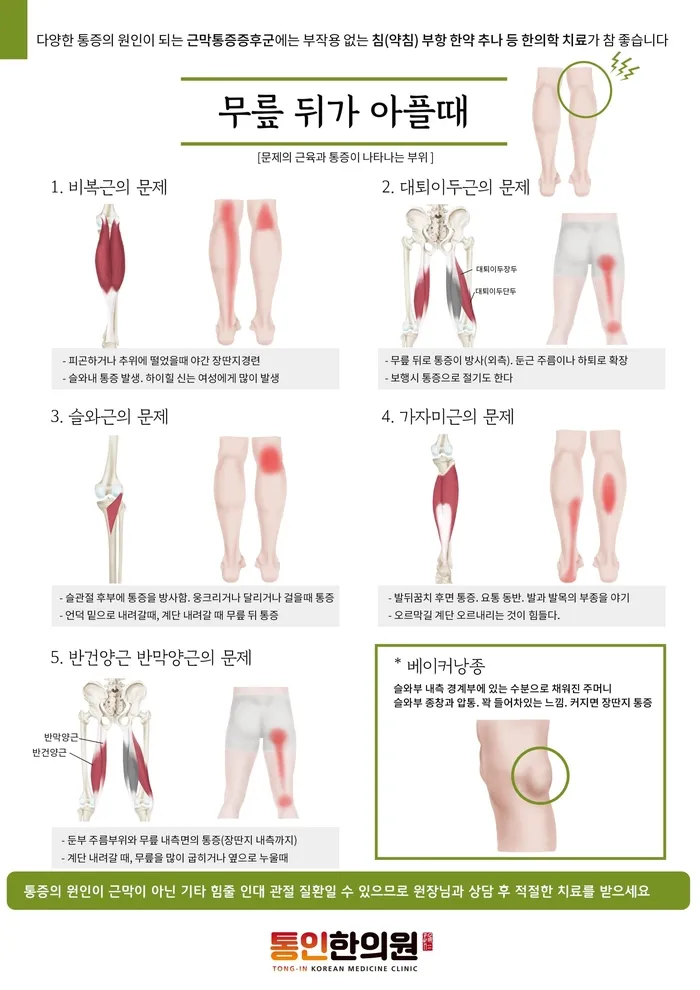 오금이당긴다 오금이쑤신다 오금통증 통인한의원.jpg