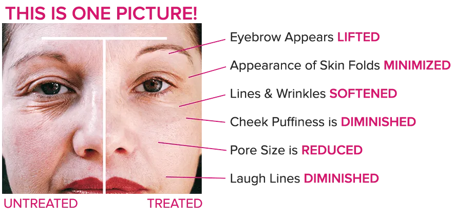 DermaWand PRO 3.png