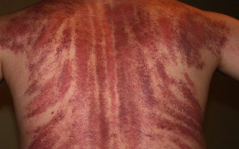 SCRATCH MARKS ON BACK.jpg