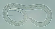 194x105_Hookworm_Infections.jpg
