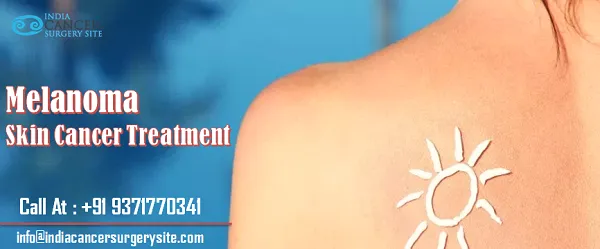 All You Need To Know About Melanoma Skin Cancer Treatment.png