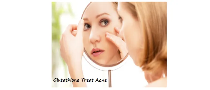 Glutathione Treat Acne.png