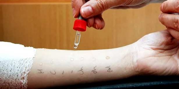 huiduitslag-diagnose-op-basis-van-klinische_1.jpg