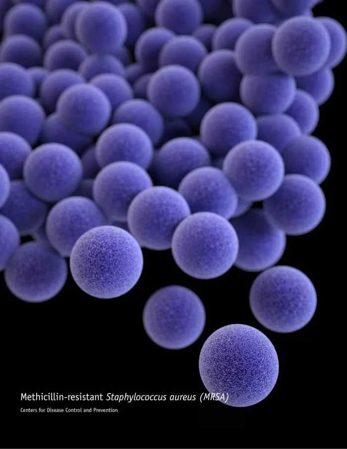 19059_lores MRSA.jpg
