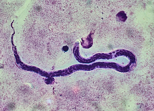 All you need to know about Loa loa the African worm parasite.