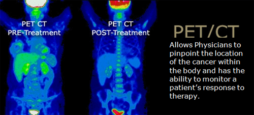 pet_ct.gif