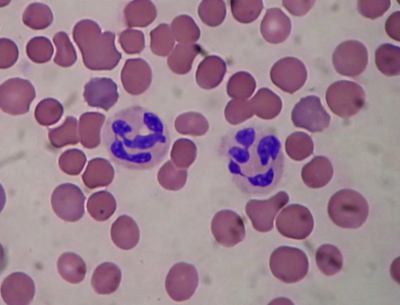 Segmented_neutrophils.jpg