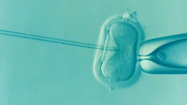 ivf-1514174_640.png