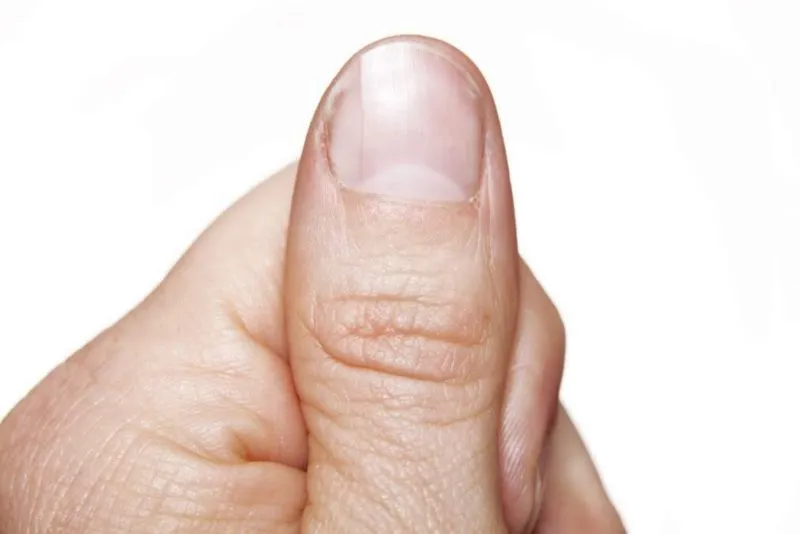 thumb-2-800x534.jpg
