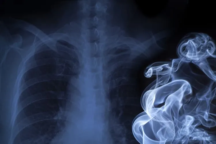 secondhand-smoke-750.jpg