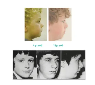 slackjaw-progression.png