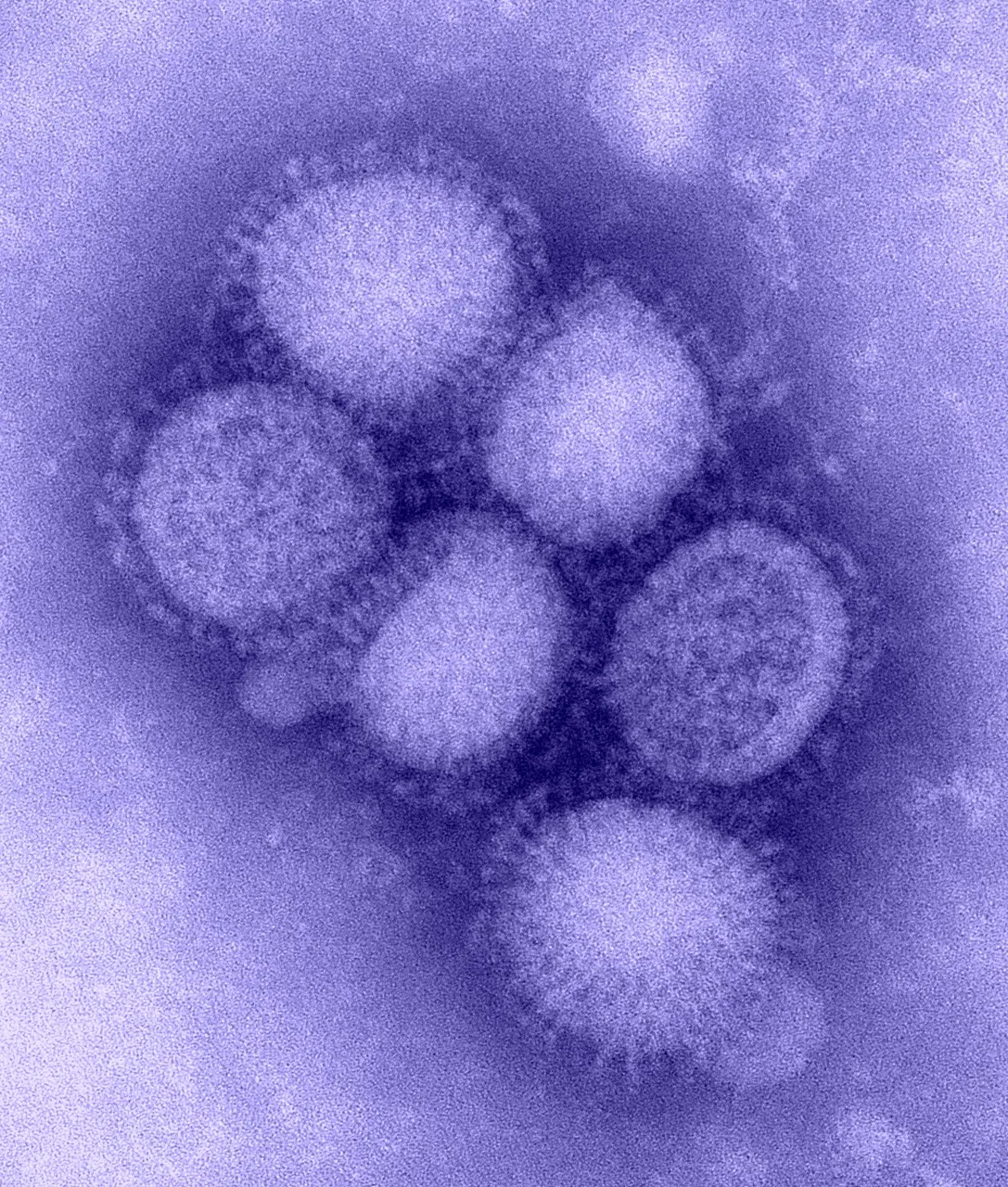 H1N1_influenza_virus.jpg