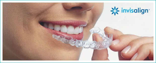 invisalign-header-1.jpg