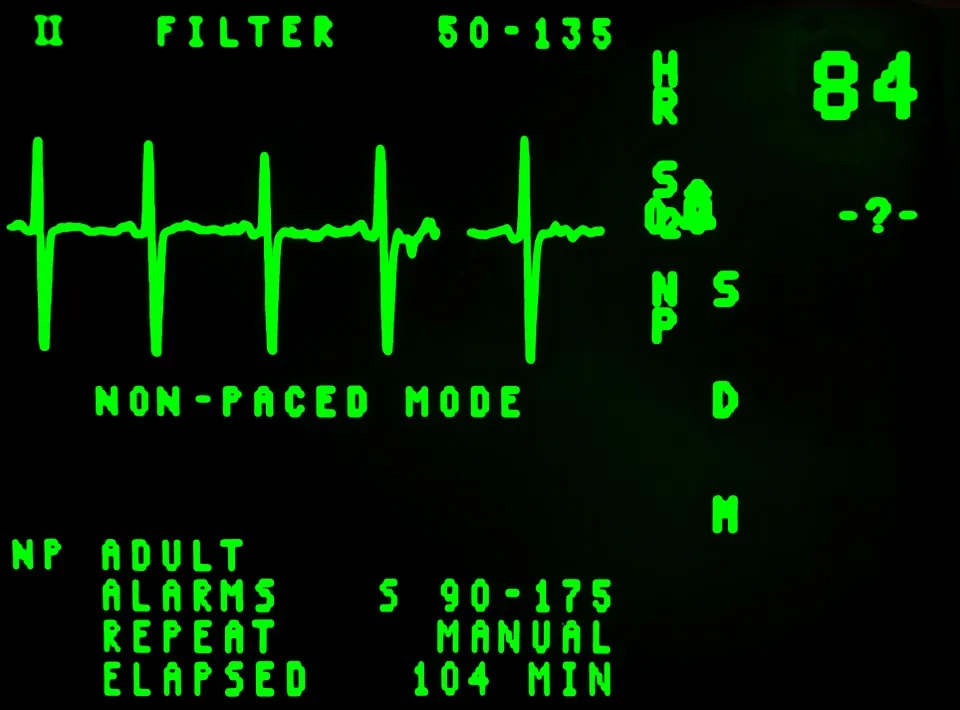 electrocardiogram-16948_960_720.jpg