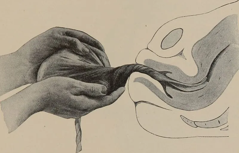 A_nurse's_handbook_of_obstetrics_(1915)_(14596009809).jpg