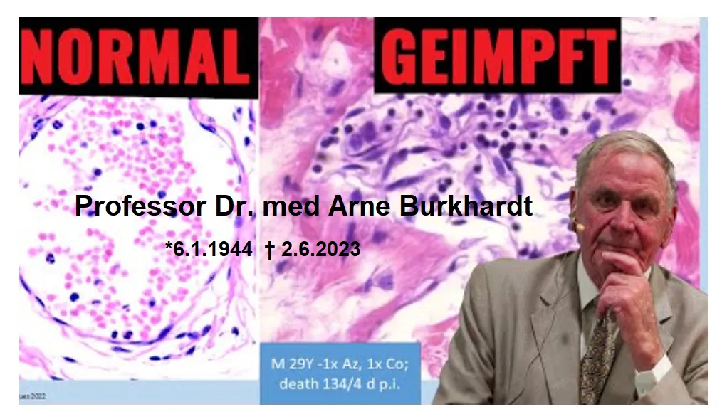 202306030134 Professor Burkhardt RIP.png