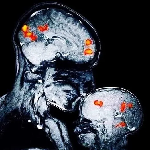 Brain, Love, See, science, study, inside head, family, family, kids 145203915_748695696022134_4249190755063920500_n.jpg