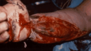 GIF200912_110837.gif