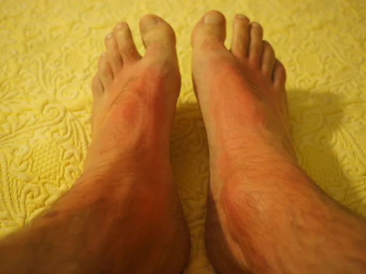 Changes-to-your-skin-6-Signs-You-May-Have-Cancer.jpg