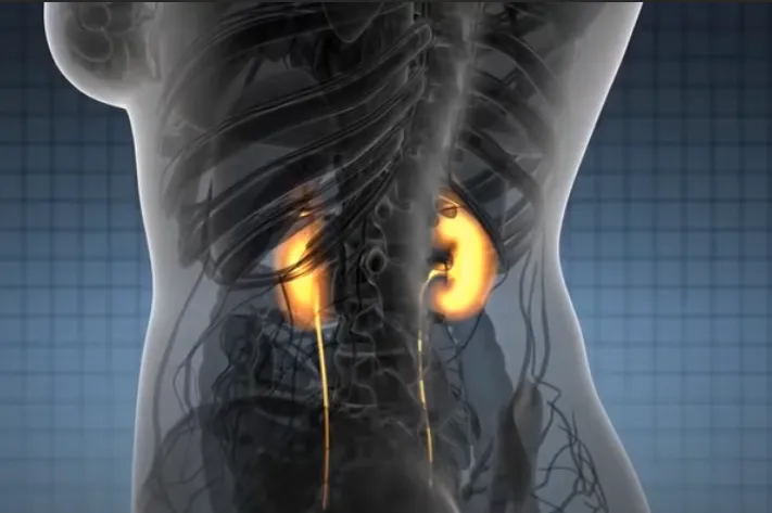 kidney4.PNG