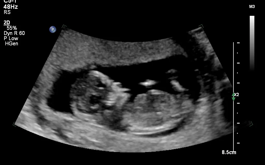 12W2D SCAN.png